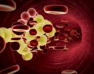 ภาวะไขมันในเลือดสูง