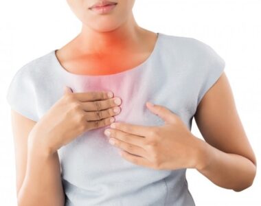 กรดไหลย้อน