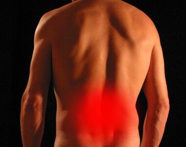 หมอนรองกระดูกเคลื่อนทับเส้น