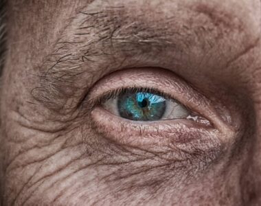 ตา แก่ วุ่นในตาเสื่อม