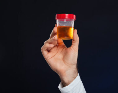 สีปัสสาวะ